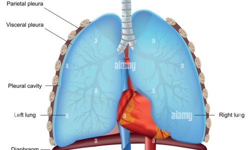 【早期肺癌没有症状是什么症状图片】早期肺癌没有症状是什么症状表现 - 早期肺癌没有症状是什么症状网